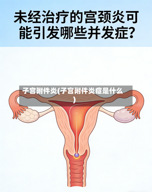 子宫附件炎(子宫附件炎症是什么)-第3张图片