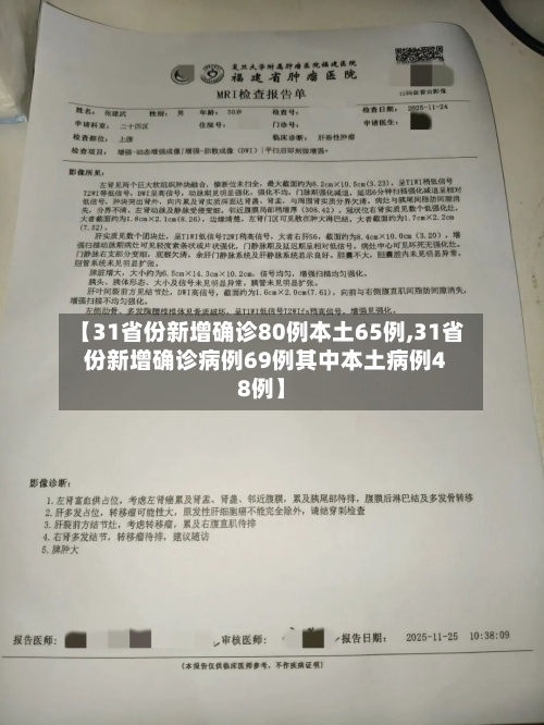 【31省份新增确诊80例本土65例,31省份新增确诊病例69例其中本土病例48例】-第3张图片