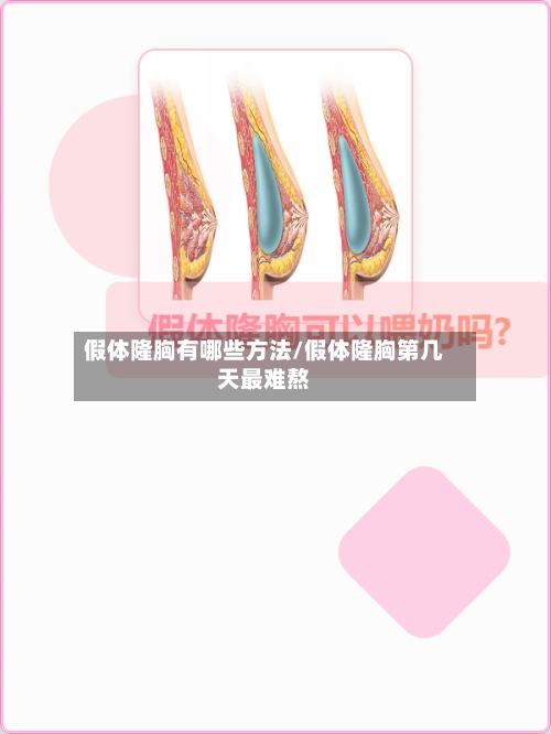 假体隆胸有哪些方法/假体隆胸第几天最难熬-第3张图片