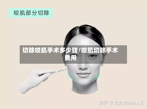 切除咬肌手术多少钱/咬肌切除手术费用-第2张图片