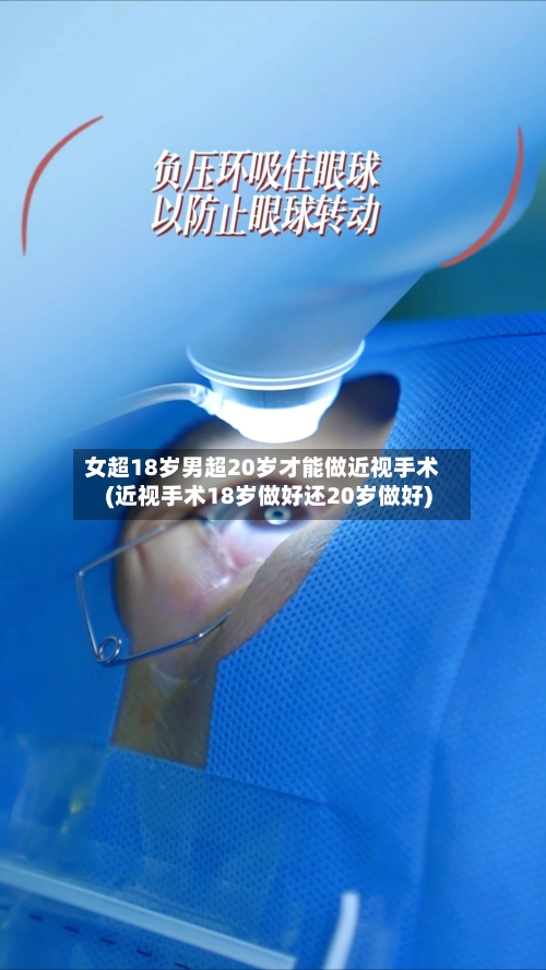 女超18岁男超20岁才能做近视手术(近视手术18岁做好还20岁做好)-第3张图片